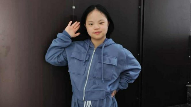 
 Janice Felicia. Foto: Istimewa 